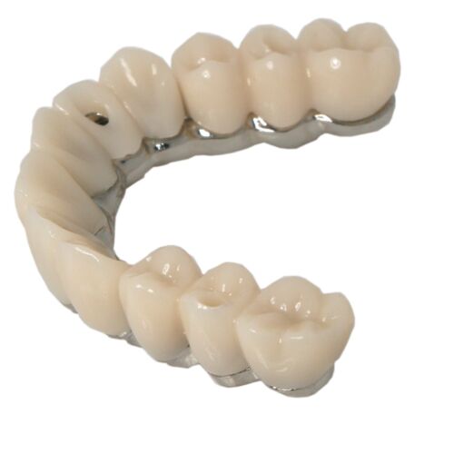 Dental Implant All-on-4 overdenture treatment Model with titanium frame,Clear - Picture 13 of 14