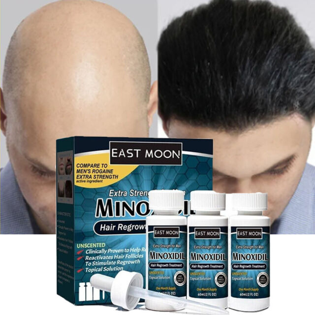3PCS Treatment Hair Regrowth Extra Strength For Men Solution Topical Hair Loss