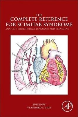 Die vollständige Referenz für Scimitar-Syndrom: Anatomie, Epidemiologie, Diagnose