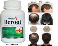 Hair Growth Vitamins For Men Anti Hair Loss Pills. Regrow Hair Beard 60caps