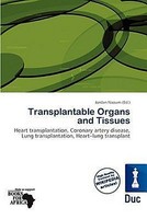 Transplantable Organs And Tissues Jordan Naoum