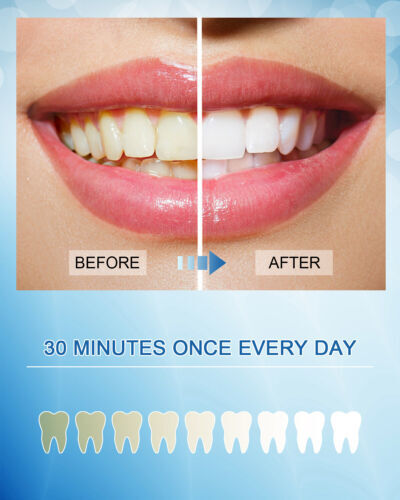 28Pcs 3D Teeth Whitening Strips Tooth Bleaching White Strips 14 Treatments