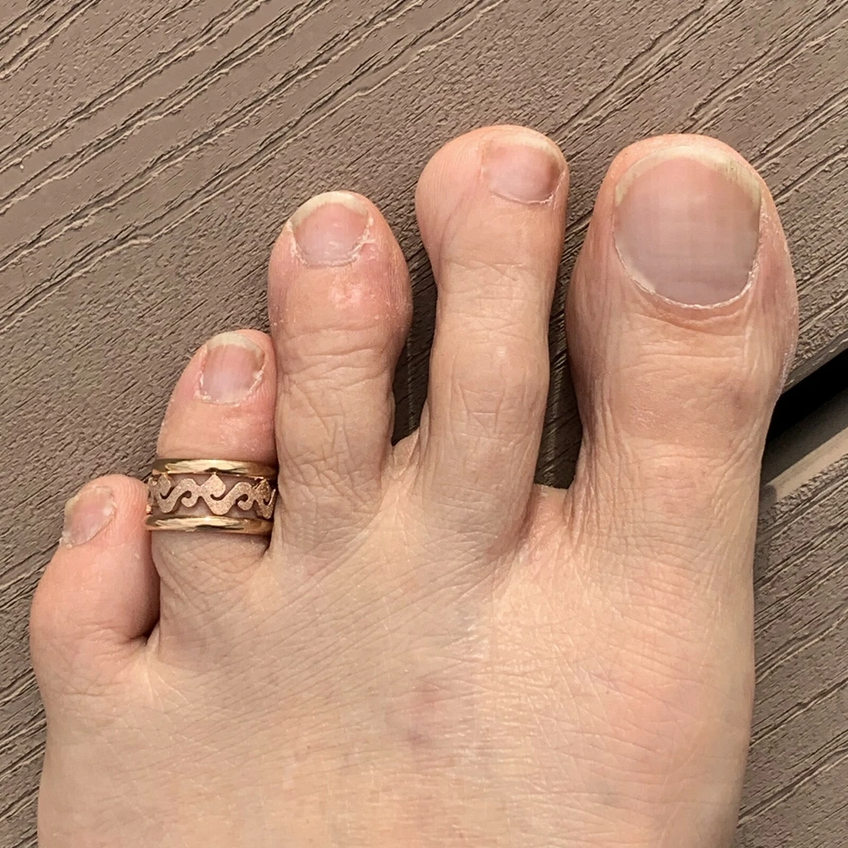 Details 155+ fitted gold toe rings latest awesomeenglish.edu.vn