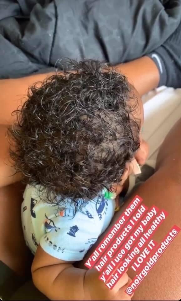 ORGANIC Children/ Baby hair Growth oil-Cradle cap, Scalp eczema, Hair Growth Oil