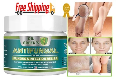 DR GREENS ANTIFUNGAL CREAM Toenail Fungus , Antifungal Cream, Athletes Foot Foot Fungus Dry Feet