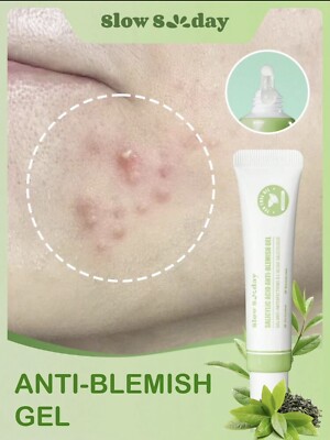 Acne Care