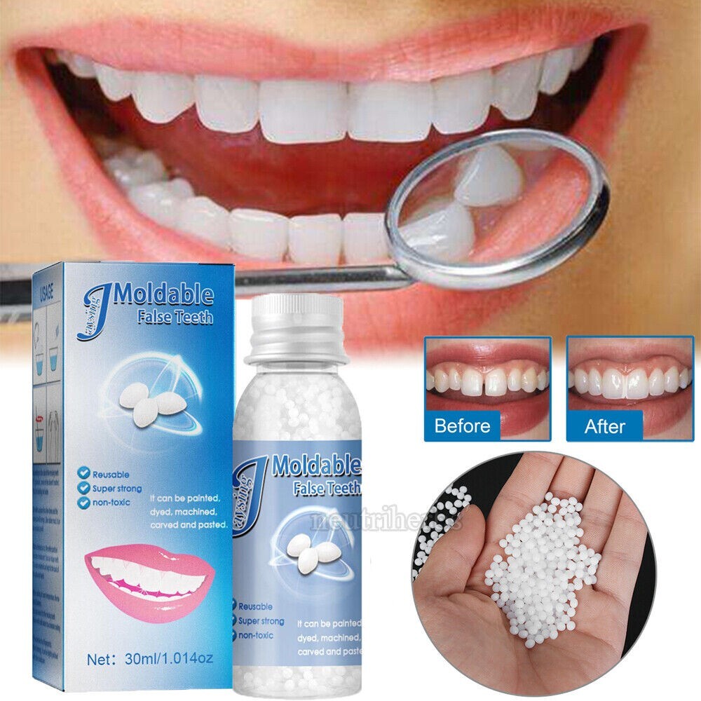 Tooth Repair Beads for Missing Broken Teeth, Dental Tooth Filling Glue