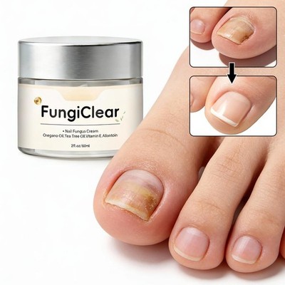 #Fungiclear Nail Fungus Cream Oregano Oil, Tea Tree Oil, Vitamin E Allantoin NEW