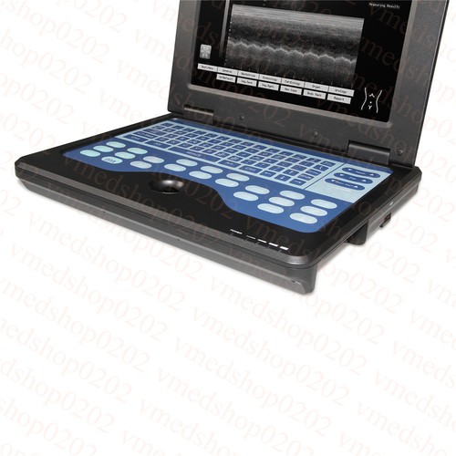 CE&FDA,Portable laptop machine Digital Ultrasound scanner,3.5M Convex probe,New - Picture 8 of 11