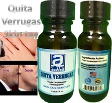 Skim Away wart remover tag away tag remover Sani Skin