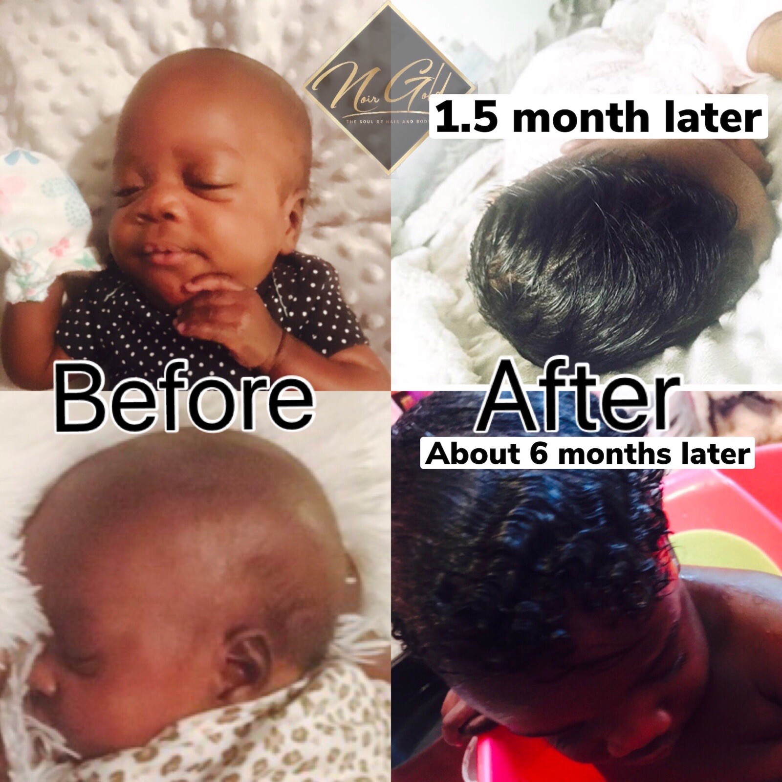 ORGANIC Children/ Baby hair Growth oil-Cradle cap, Scalp ecz