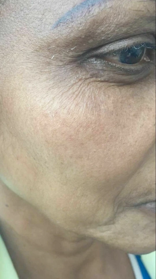 White Fade Super Skin Lightener Cream, Para Piel Triguena o Morena 2oz. - Image 3 of 4