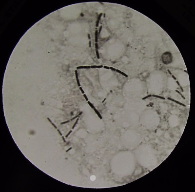 Glas Magic Lantern Slide B ANTHRAX NO1 UM 1910 MIKROSKOP FOTO 