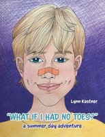Lynn Kastner | What If I Had No Toes? | Taschenbuch | Englisch (2021)