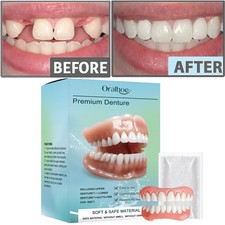 DIY Resin Dentures Veneers Set For Men And Women Upper And Lower False Teeth