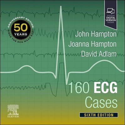 160 ECG Cases Joanna Hampton