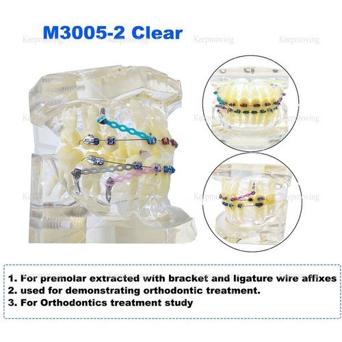 Modelo de dientes tipodonte dental ortoimplante patológico período práctica modelo de demostración - Imagen 13 de 41