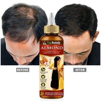 Sweet Almond Oil for Skin and Hair, Cold Pressed Almond Oil, Almond Body Oil