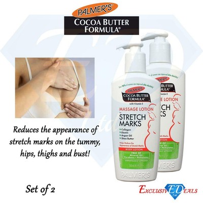 stretch marks body lotion