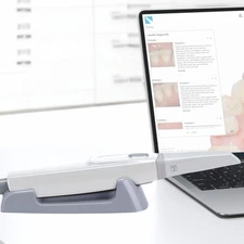 Dental Intra-oral Scanner 3D Real-time Display Software GreatLife w/Scanning SW