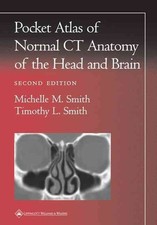 Pocket Atlas of Normal CT Anatomy of the Head and Brain by Michelle M. Smith (En