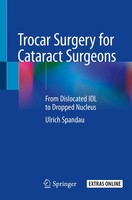 Ulrich Spandau | Trocar Surgery For Cataract Surgeons | Taschenbuch | Englisch