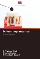 Twinkle Modi (U. A.) | ÉChecs Implantaires | Taschenbuch | FranzöSisch (2024)
