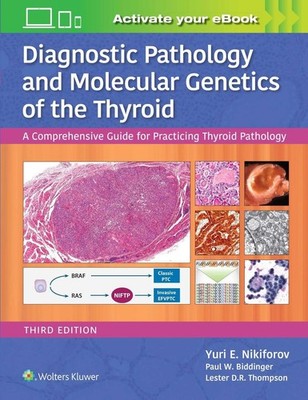Diagnostic Pathology and Molecular Genetics of the Thyroid: A Comprehensive Guid