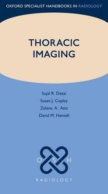 Thoracic Imaging by Sujal R. Desai, Susan J. Copley, Zelena A... - 9780199560479