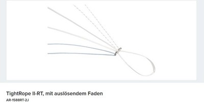 Arthrex TightRope II-RT m. auslösendem Faden