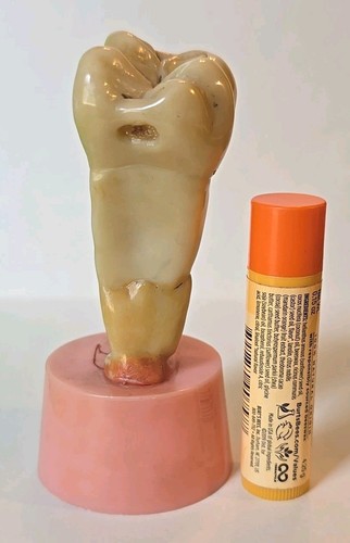 Mid Century Dentist Dental Oversized Tooth Oral Anatomy Teaching Model Figure - Picture 4 of 6