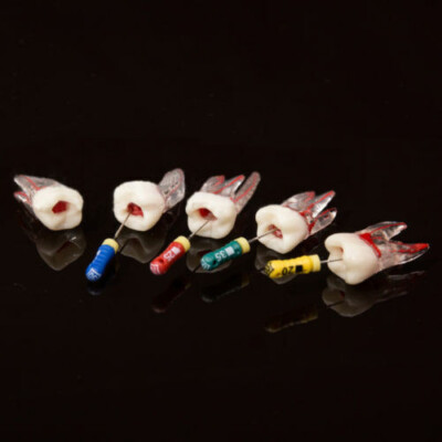 Rct Endo Block Dental Tooth Endo Root Canal Training Model For RCT Practice Block Pulp ...