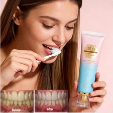 Niacinamide Whitening Toothpaste,Natural Niacinamide Toothpaste,Teeth Whitening