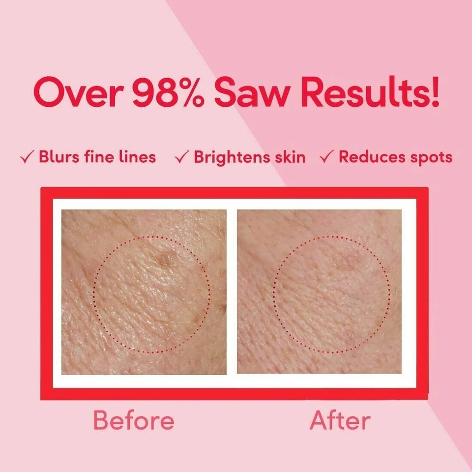 Crema de 50 días POND'S Age Miracle reduce la piel facial antienvejecimiento líneas finas arrugas Foto 4 de 4