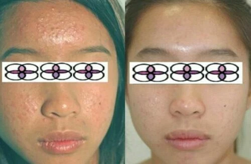 10-20-30-40-50-60-70% Glycolic Acid Night Cream 2oz/ 60ml Aging/Acne/scar - Image 4 of 4