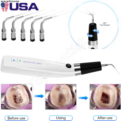 Dental Ultra Activator Irrigator Scaling Handpiece 6 Tip for Root Canal Cleaning