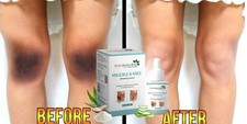 Natural Skin Brightening Serum Removing Dark Knuckles From Hand Elbow Knee 30ml