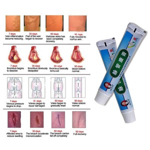 20g Herbal Ointment Health Care Skin Care Anti-acne ...