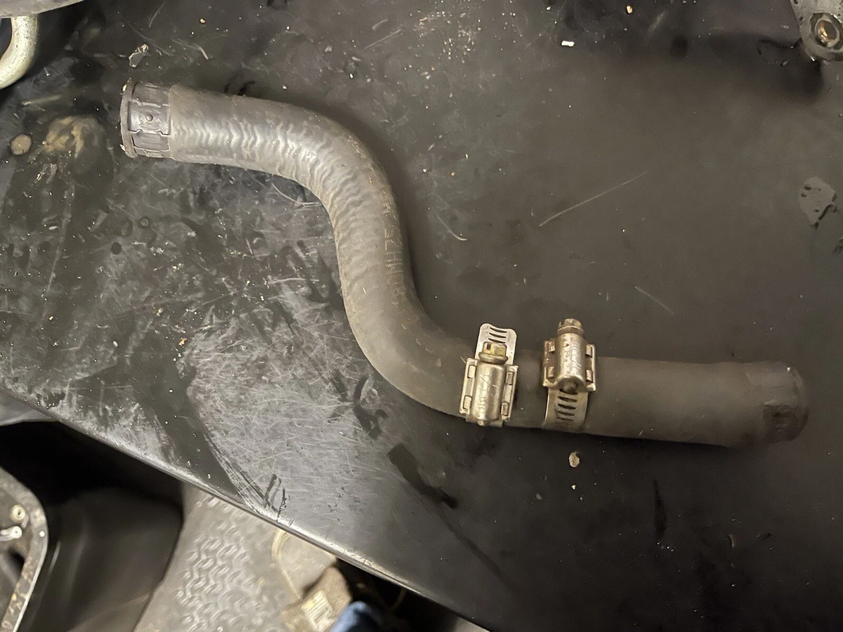 Causes Of Radiator Hose Collapse (and How To Easily Fix It)