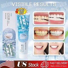 Scoban Teeth Whitening Toothpaste Scoban Teeth Whitening with Baking Soda