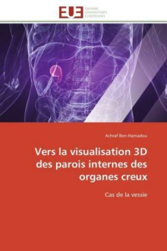 Vers La Visualisation 3d Des Parois Internes Des Organes Creux Cas De