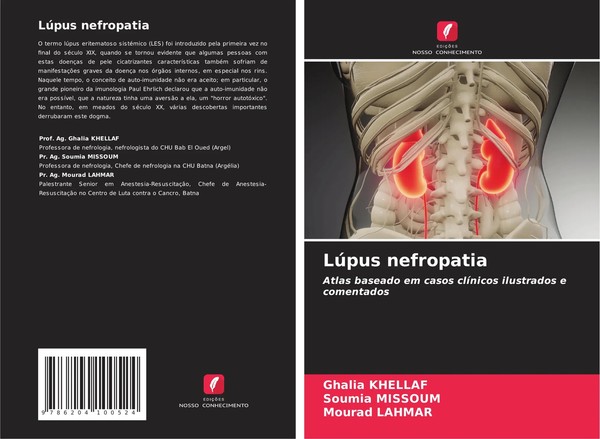Ghalia Khellaf (U. A.) | LúPus Nefropatia | Taschenbuch | Portugiesisch (2021)-image