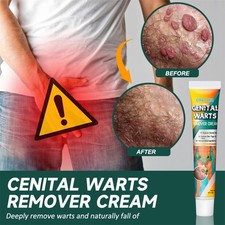 20g Genital Wart Removal Cream Skin Treatment Wart Remover Fast Acting Formula