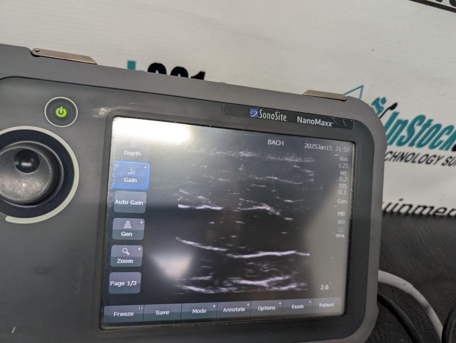 SonoSite NanoMaxx Portable Ultrasound Machine w/ L25, P21 Probes & Power Supply