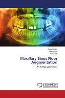 Divya Thakur (U. A.) | Maxillary Sinus Floor Augmentation | Taschenbuch (2021)