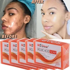 5-1X Kojic Acid Soap Acne Dark Spot Remover Skin Lightening Whitening Face Body