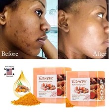 Tumeric Soap Skin Whitening Dark Spots lightening Acne Brightening Turmeric USA
