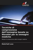 Tecniche Di Compressione Dell'immagine Basate Su Wavelet Per Le Immagini Mediche
