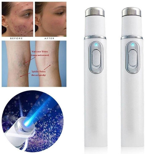 Blue Light Therapy Varicose Veins Pen - Soft Scar Wrinkle Removal New - UK - Picture 5 of 12