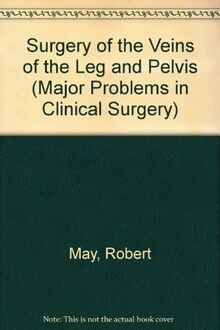 Surgery of the Veins of the Leg and Pelvis (Major Proble... | Buch | Zustand gut